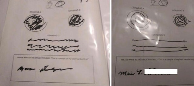 Potpis jedne bake prije i nakon što je njezin tremor tretiran fokusiranim ultrazvukom