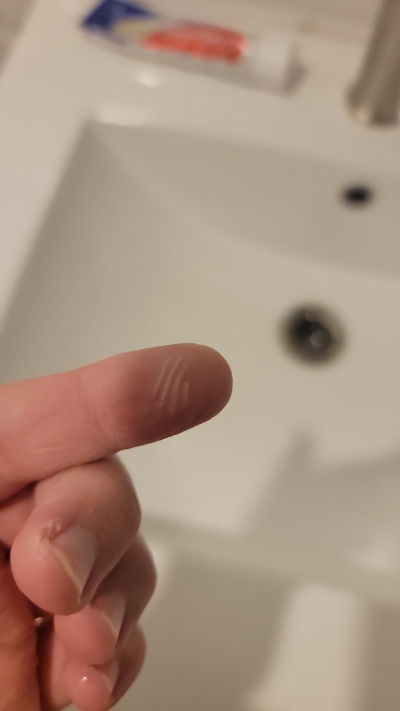 "Probudio sam se s ovim naborima na jagodici prsta. Nemam ni približno ideju kako su nastali... Ne, nemam kućne ljubimce ako ste to promislili!"