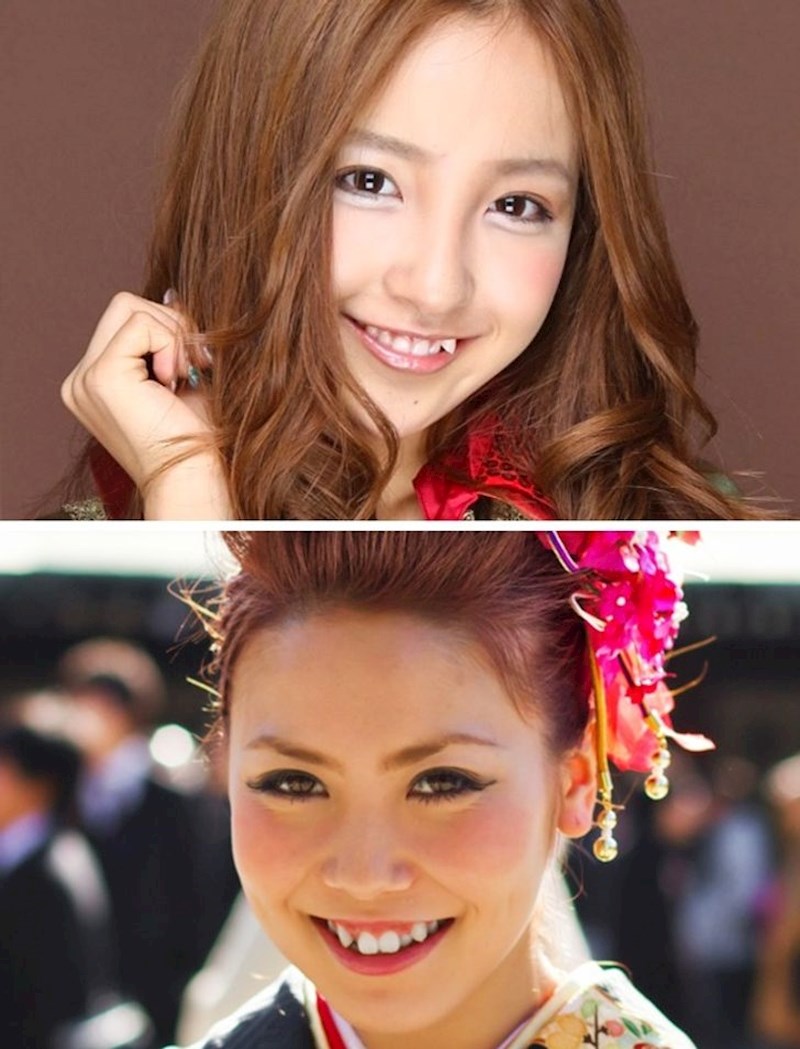 Nepravilni zubi- Japan