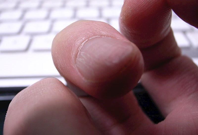 Kada povučeš zanokticu pa otkineš kožu do lakta