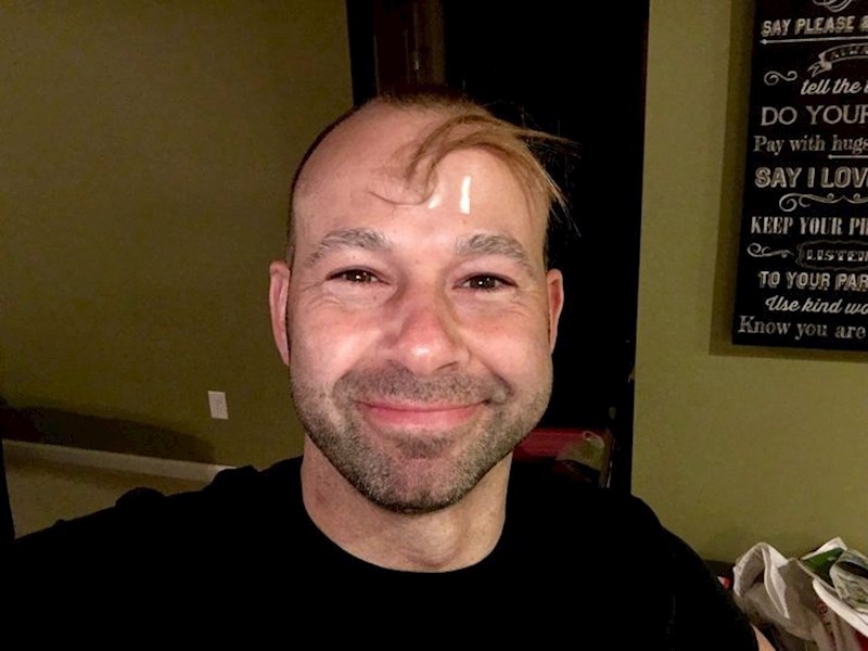 Nećakinja je odrezala pramen kose da mu "izliječi" ćelavost