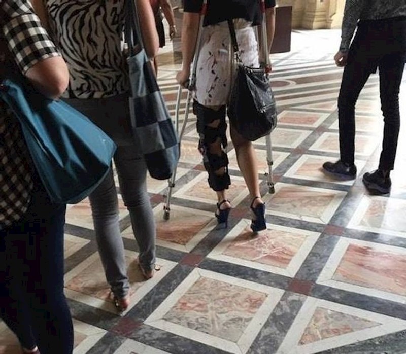 Kakav to događaj mora biti u pitanju da je žena obukla štikle na ovakvo stanje noge?