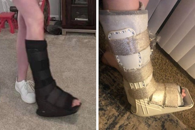Slomila je nogu tjedan prije vjenčanja, ali to je neće spriječiti da zablista!