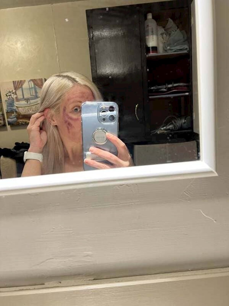 Probala je uređaj za čišćenje pora prije važnog intervjua