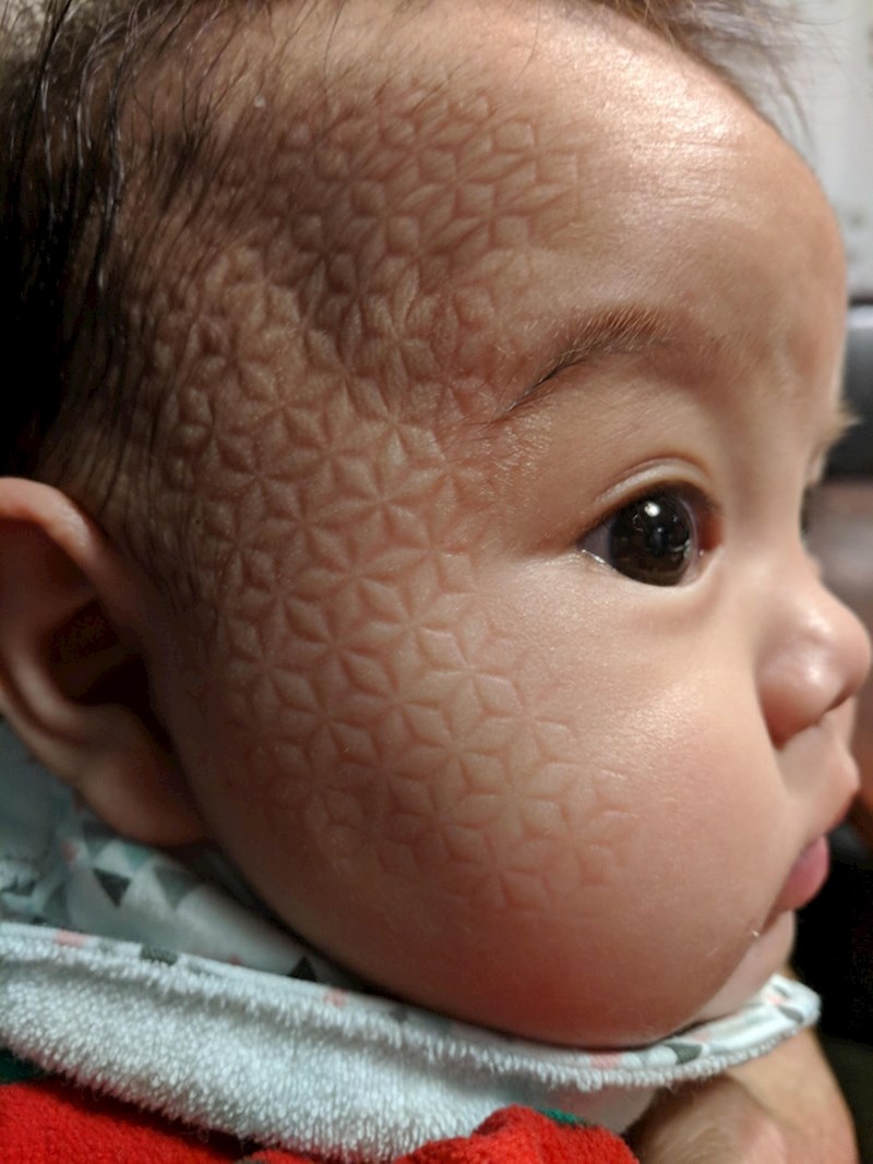 Zaspala je na podmetaču