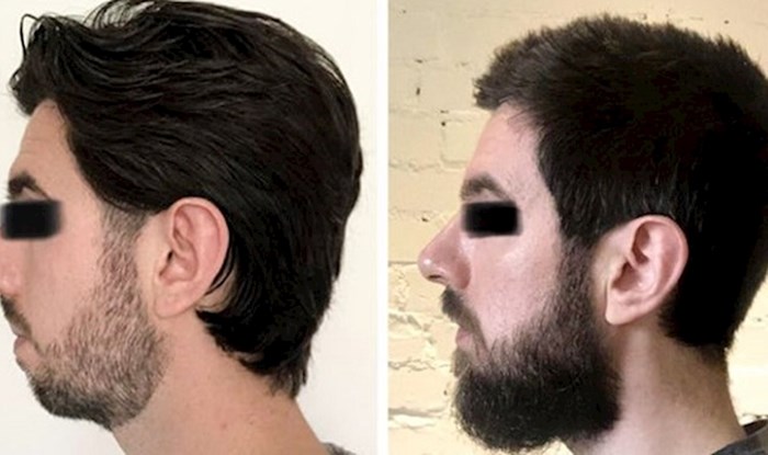 15 puta kada su muškarci pustili brade koje su ih transformirale do neprepoznatljivosti