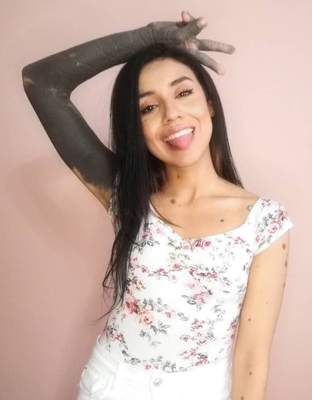7.