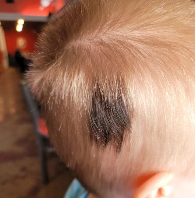 Dečko plave kose ima slatku crnu mrljicu iz koje će uvijek rasti kosa druge boje
