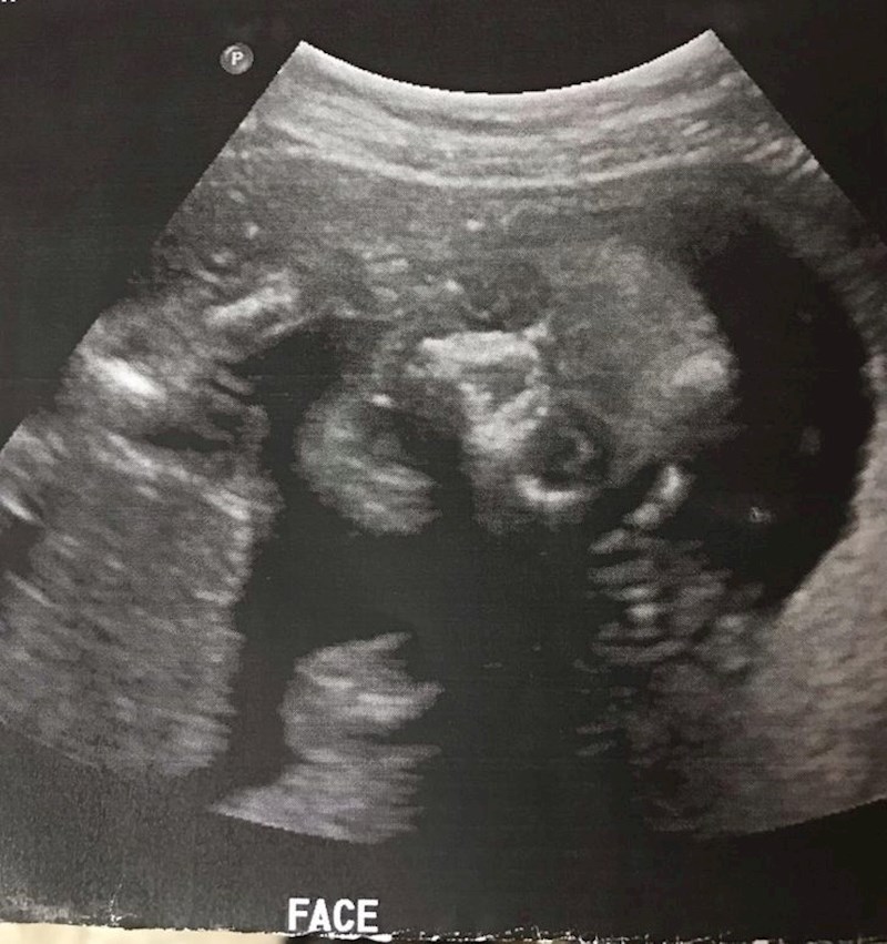 "Muž se prestravio slike naše prve bebe s ultrazvuka...."