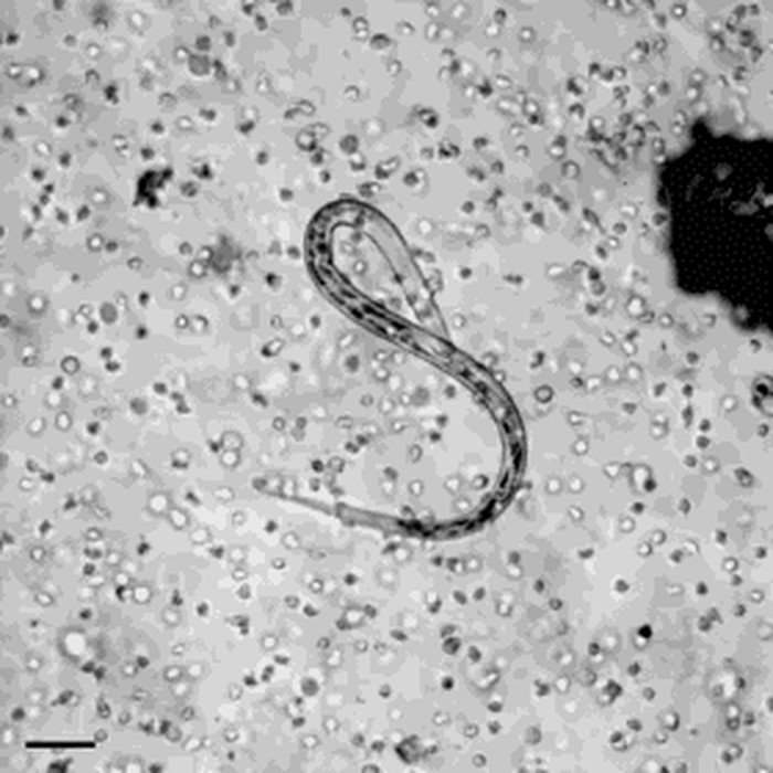 Rat pod mikroskopom: Ljudski obrambeni sustav napada parazita