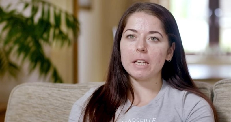 Doktori su joj rekli da ima najgori slučaj akni koji su ikad vidjeli, pogledajte kako je nekad izgleda