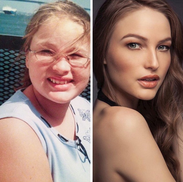 Na lijevoj fotografiji ima 13 godina, a na desnoj 25. Nosila je aparatić za zube, išla na korekciju vida, postala fizički aktivnija i počela je jesti zdravu hranu.