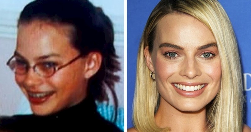 8 slavnih ljepotica koje su u mladosti nazivali ružnim pačićima, a sada su uzor milijunima