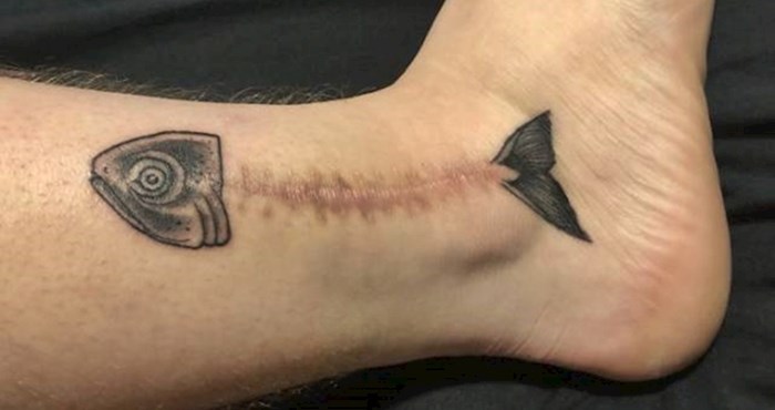 25 zanimljivih primjera ljudi koji su svoje ožiljke sakrili genijalnim tetovažama