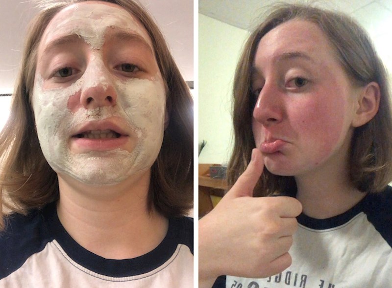 Kad ti maska uništi lice...