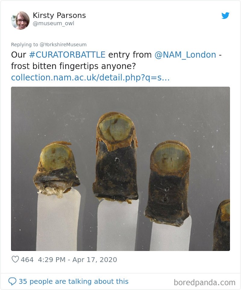 Ovaj muzej čuva vrhove prstiju koji su odumrli zbog velike hladnoće, tj. smrzavanja tkiva.