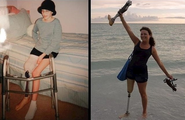 Žena se ponovno slikala 10 godina nakon što je pobijedila rak.