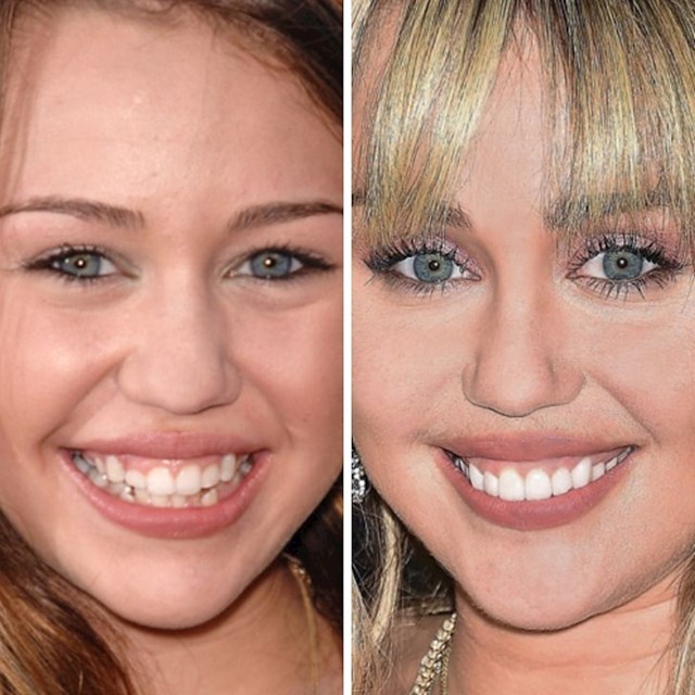 Miley Cyrus (13 i 26 godina)