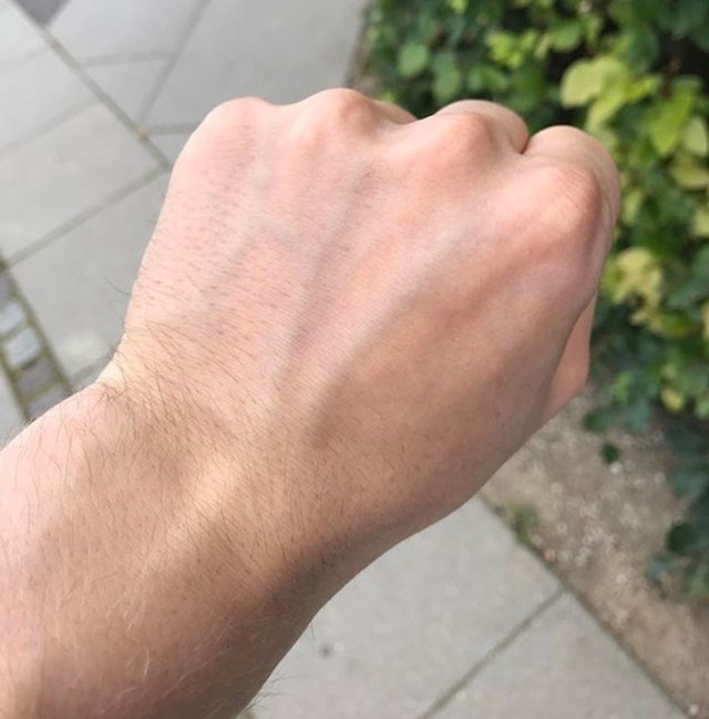 "Moje vene me pozdravljaju, napisale su HI!"