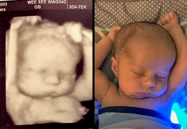 Beba prije i nakon rođenja