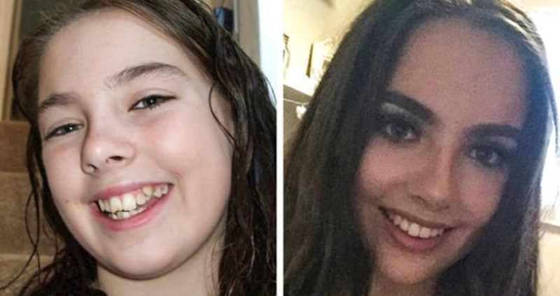 NEKAD I SAD 🤩 Pogledajte koliko im se izgled promijenio nakon nošenja zubnih aparatića