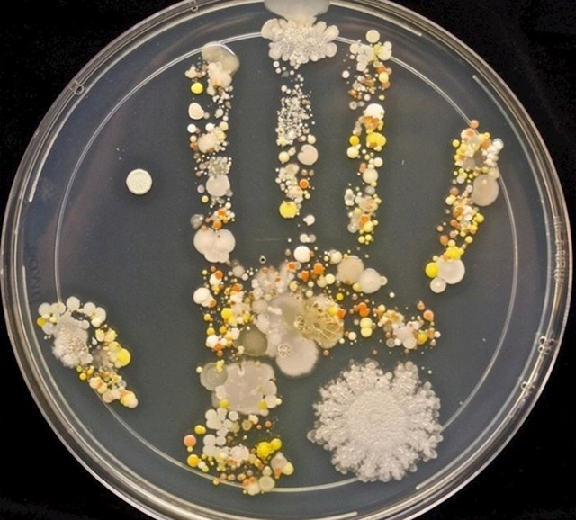 Napravili su mikrobiološku analizu otiska dlana djeteta koje se satima igralo vani.