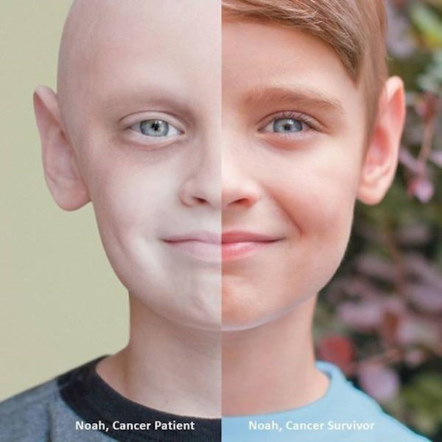 Dječak dok se liječio od raka i nakon ga je pobijedio