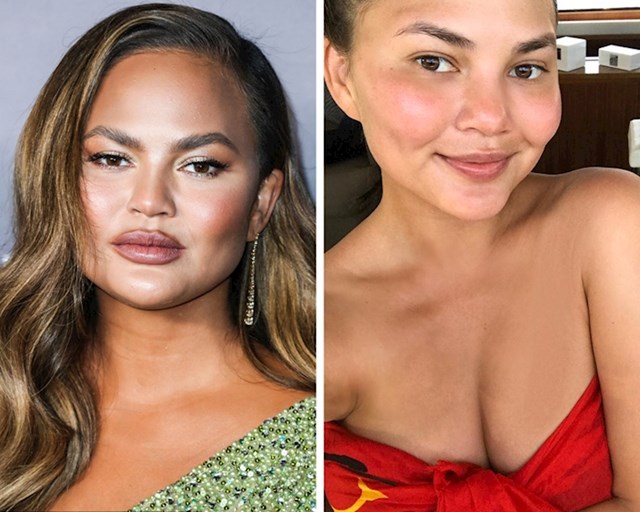 Chrissy Teigen