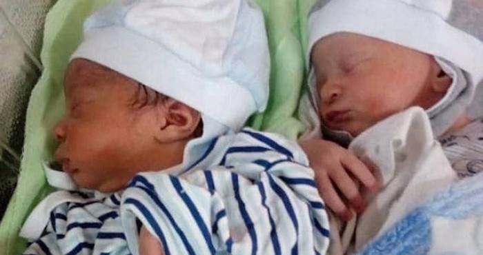 Ove bebe su rođene kao blizanci, no nećete vjerovati koliko su već danas različiti