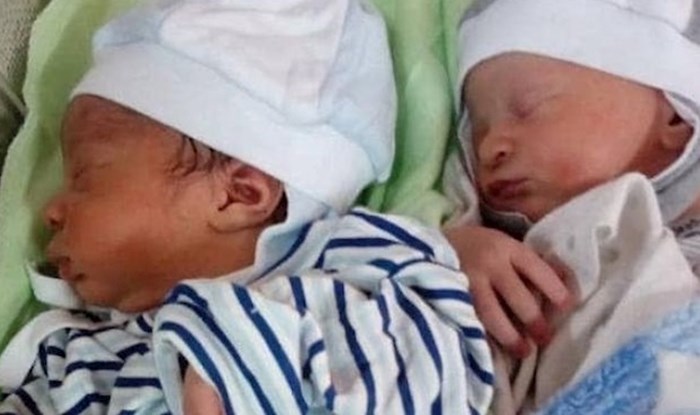 Ove bebe su rođene kao blizanci, no nećete vjerovati koliko su već danas različiti