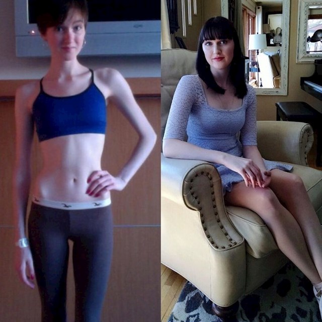 "Oporavila sam se od 8-godišnje borbe s anoreksijom."