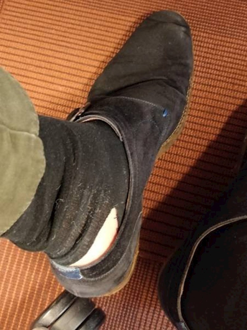 "Na poslu sam htio podići čarapu, a onda mi se dogodilo ovo..."