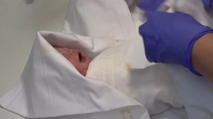 VIDEO Ova beba je medicinsko čudo, rođena je 117 dana nakon što je njena majka proglašena klinički mrtvom