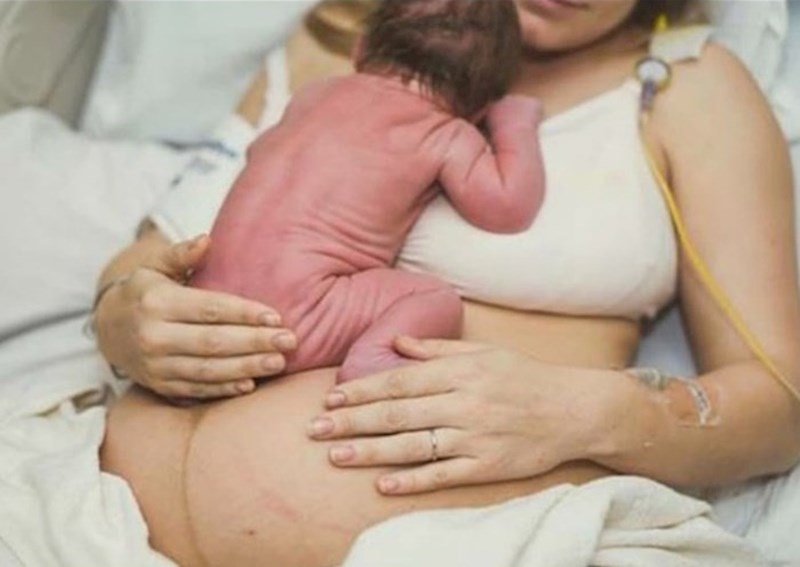 Ni bebina koža često ne izgleda kao u filmovima.