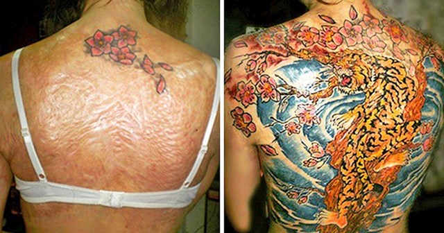 Ova žena je imala velike opekline na leđima. Sakrila ih je pomoću tetovaže.