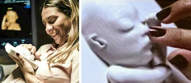 Doktor je slijepoj trudnici napravio 3D printano lice njenog budućeg djeteta.