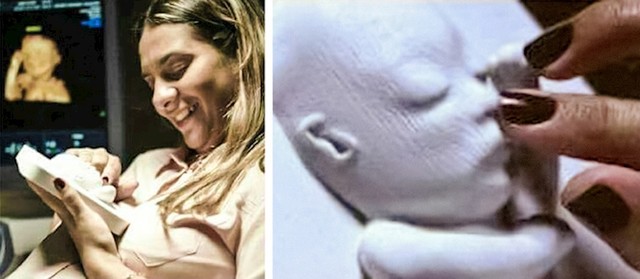 Doktor je slijepoj trudnici napravio 3D printano lice njenog budućeg djeteta.