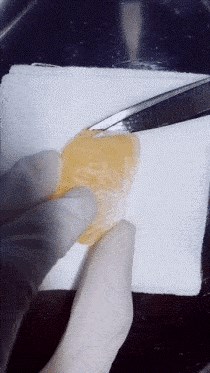 Sportaši vježbaju u teretani, medicinari vježbaju na voću: Ovaj komadić mandarine je imao operaciju!