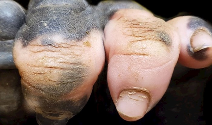 Internet se čudi slici ovih prstiju, iznenadit ćete se kad vidite čiji su oni zapravo