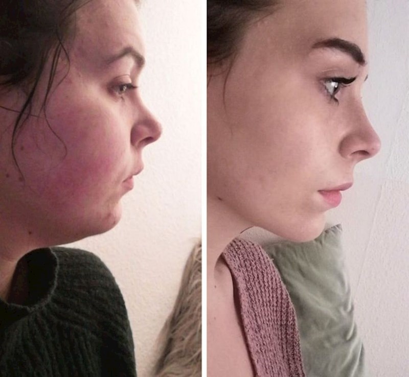 "Botoks, zubni aparatić, estetski zahvat... Ne, samo sam skinula 20 kg!"