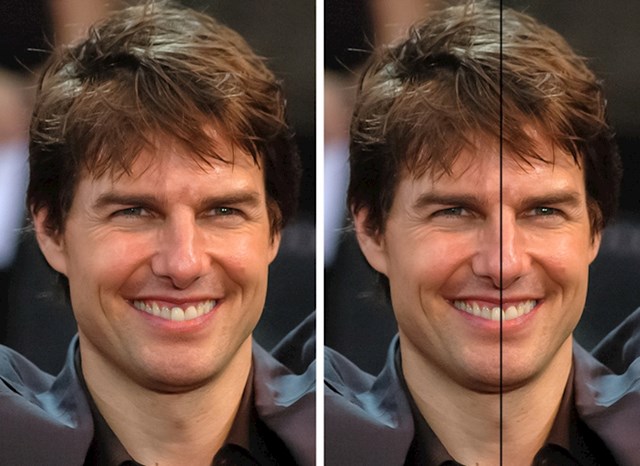 Jeste li ikad primijetili da Tom Cruise ima asimetrične zube? Jedan veliki prednji zub mu je na sredini lica.
