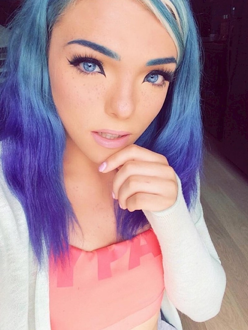 Waardenburgov sindrom