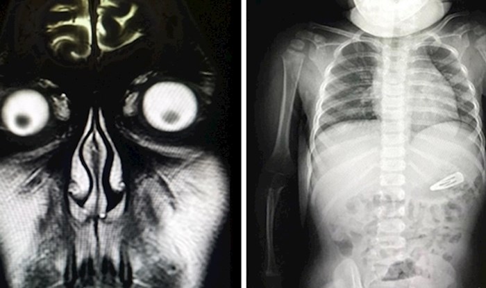 15 rendgenskih slika koje su otkrile zanimljive i potpuno neočekivane detalje