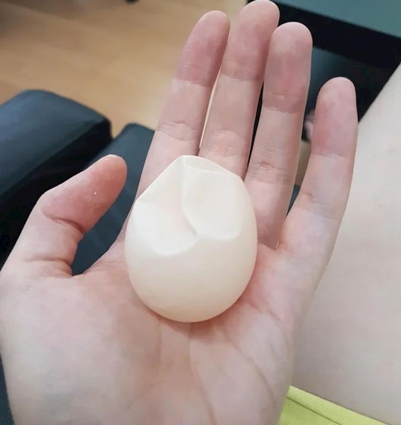 "Evo što se dogodi kad kokoš s manjom kalcija snese jaje."