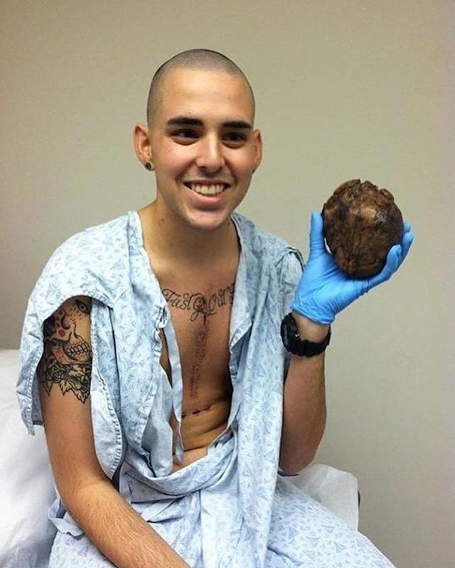 Mladić nakon uspješne transplantacije drži svoje staro srce
