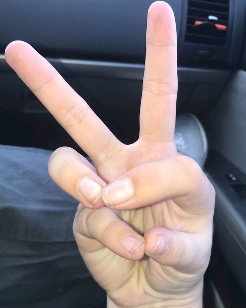 Što nije u redu na ovoj fotki?