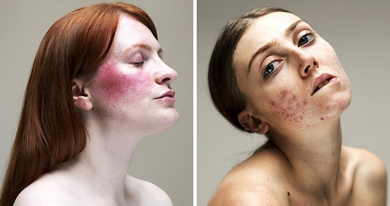 U svijetu filtera i Photoshopa, ova fotografkinja prikazuje ono što većina žena želi sakriti