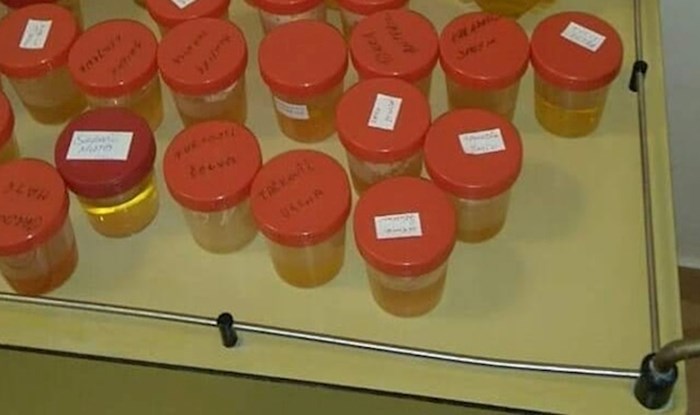 Pacijent je slikao neočekivan prizor u laboratoriju za analizu urina, pogledajte što ga je nasmijalo