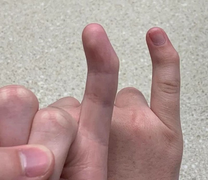 "Rođen sam s čudnim prstima..."