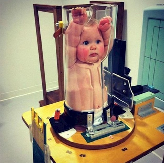 Kako izrađuju rendgenske slike kod beba